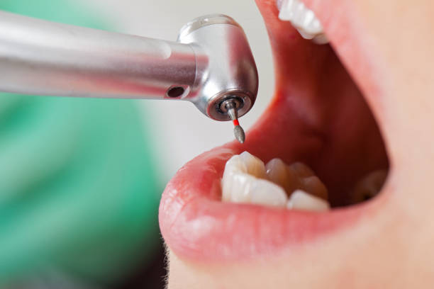 Best Urgent Tooth Repair  in Virginia Gardens, FL